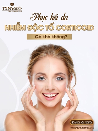 Phục hồi da nhiễm độc tố Corticoid