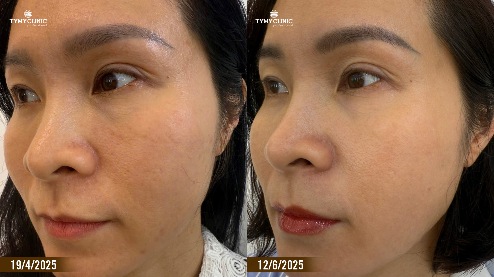 Góc trả kết quả da khoa học