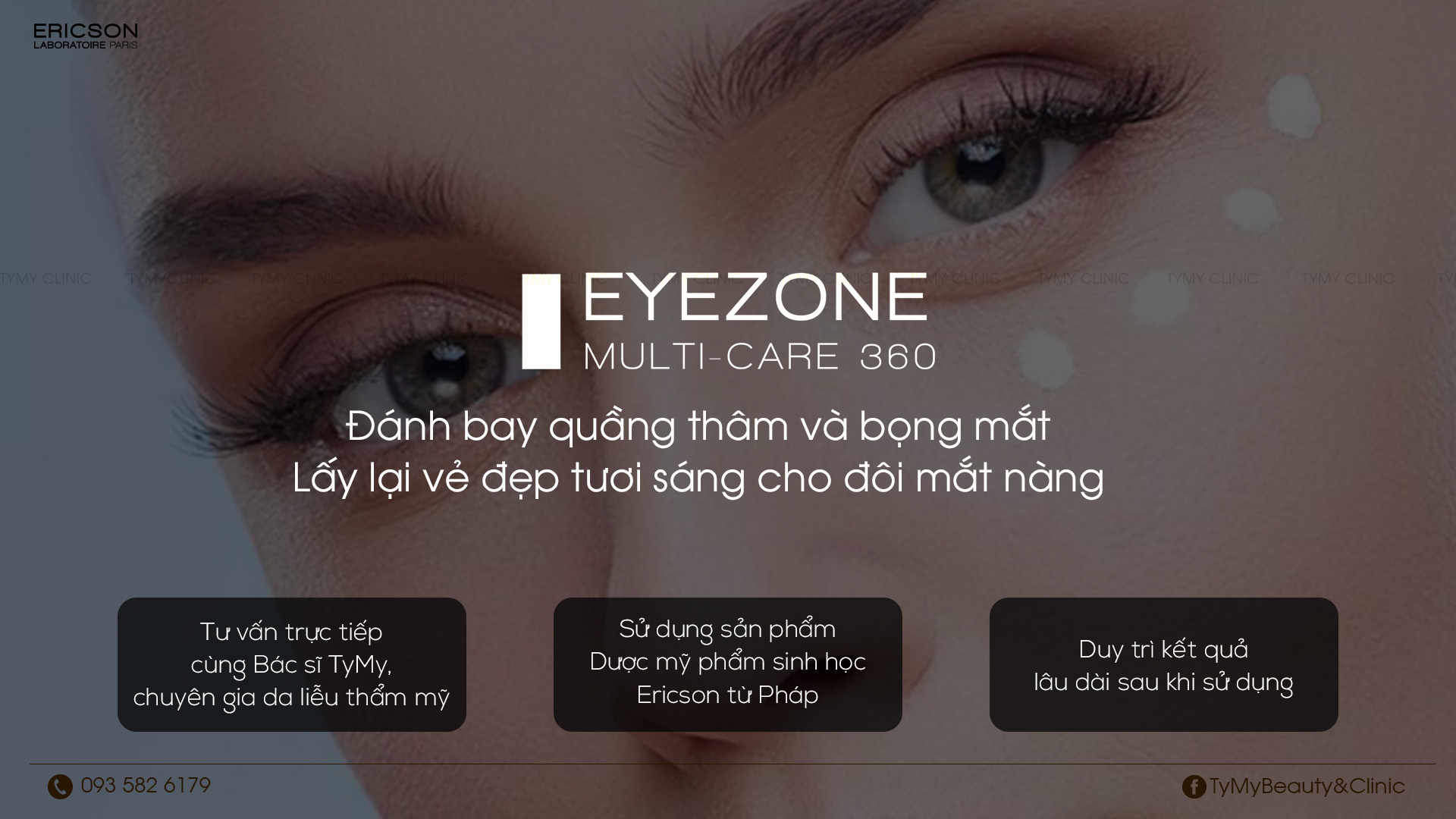 Kem chống thâm mắt 'Eye zone multi care 360'